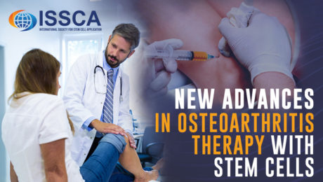 ISSCA – New advances in osteoarthritis therapy with stem cells