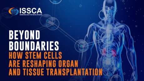 Beyond Boundaries How Stem Cells Are Reshaping Organ and Tissue Transplantation